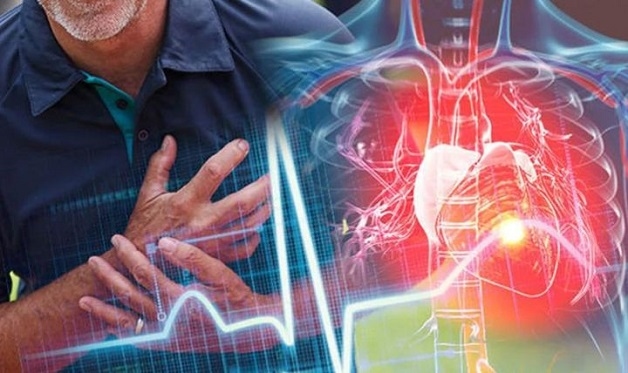 Tim mạch là một trong những nhóm bệnh lý gây tử vong hàng đầu trên thế giới.