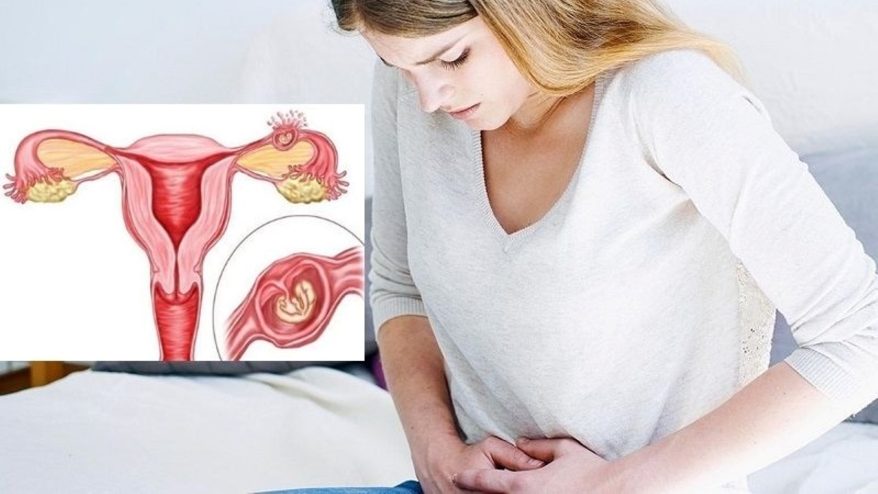 Dấu hiệu thai ngoài tử cung bị vỡ &#8211; Mẹ bầu cẩn trọng!