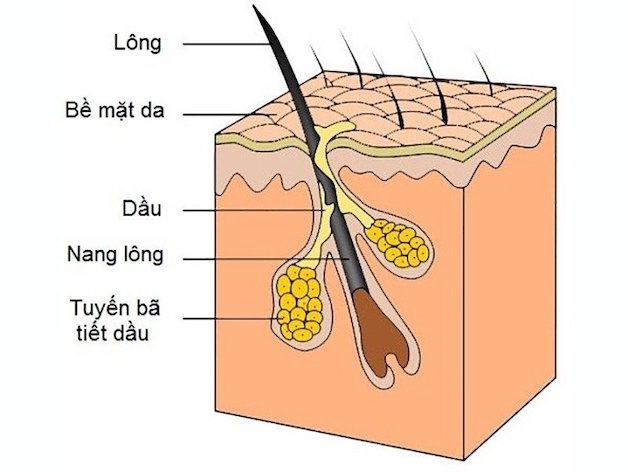 Khi tuyến bã nhờn gặp vấn đề sẽ dẫn đến sự hình thành các hạch ở sau tai.