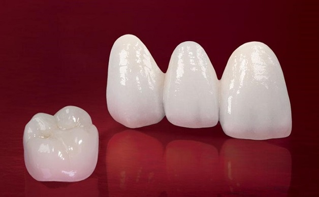 Cả mặt trong và mặt ngoài của răng sứ Cercon đều được làm hoàn toàn bằng sứ