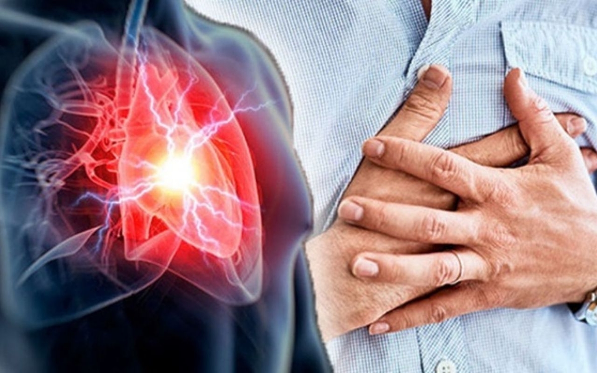 4 chụp chiếu, xét nghiệm nhồi máu cơ tim quan trọng 
