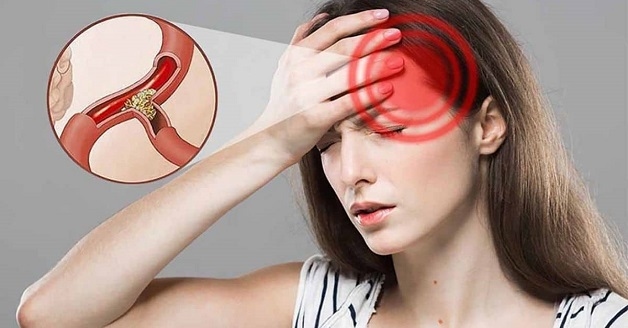 Thiếu máu não gây đau đầu sau gáy