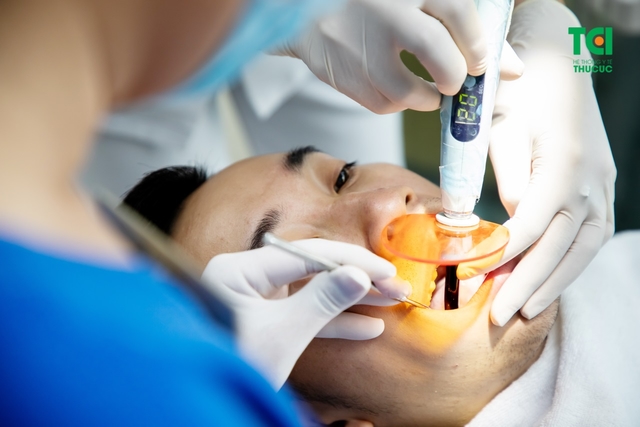 Nhổ răng cấm hàm trên có nguy hiểm không? 