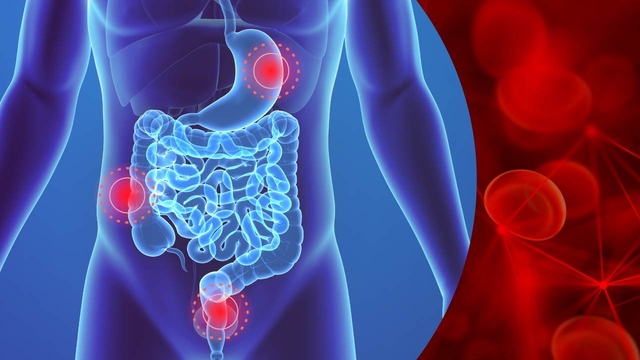 Bệnh xuất huyết tiêu hóa: Nguyên nhân và triệu chứng
