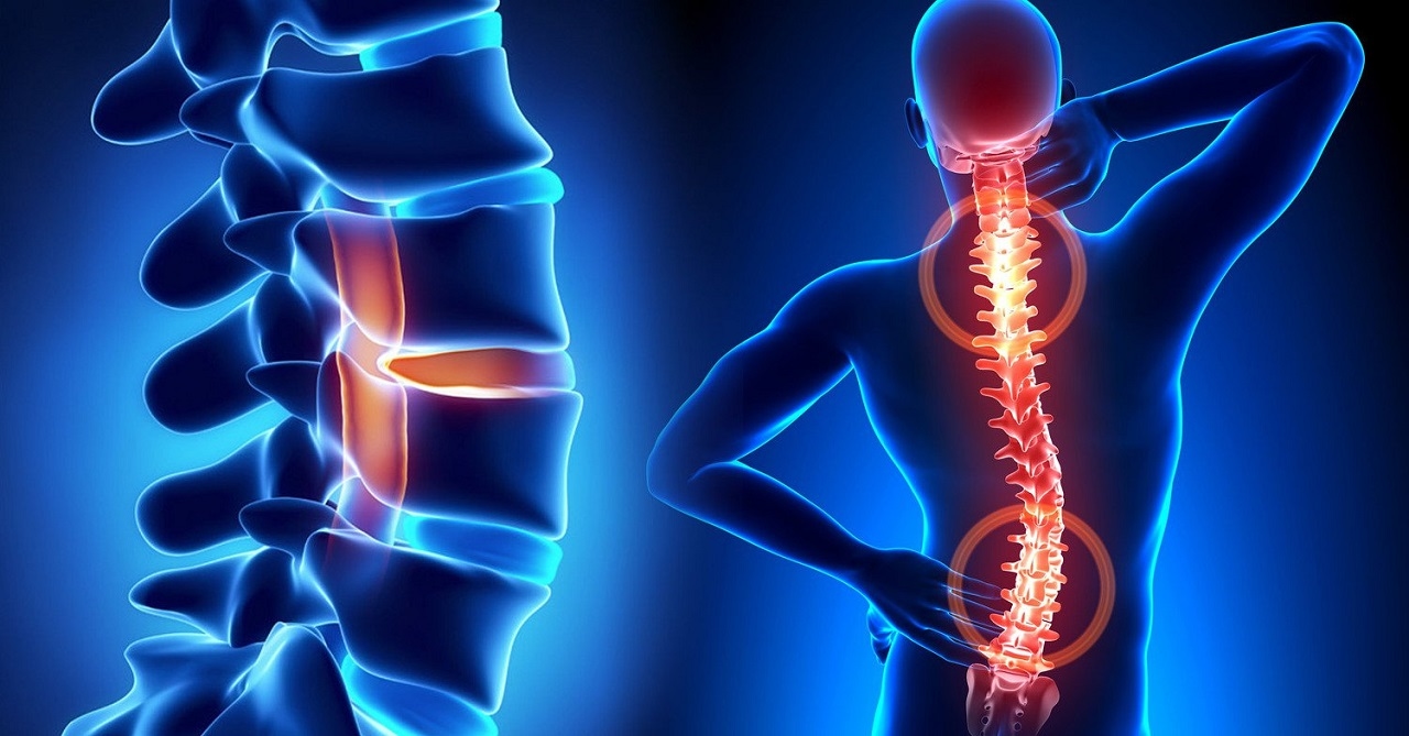 Bệnh lý tủy sống thường gặp: chẩn đoán và điều trị