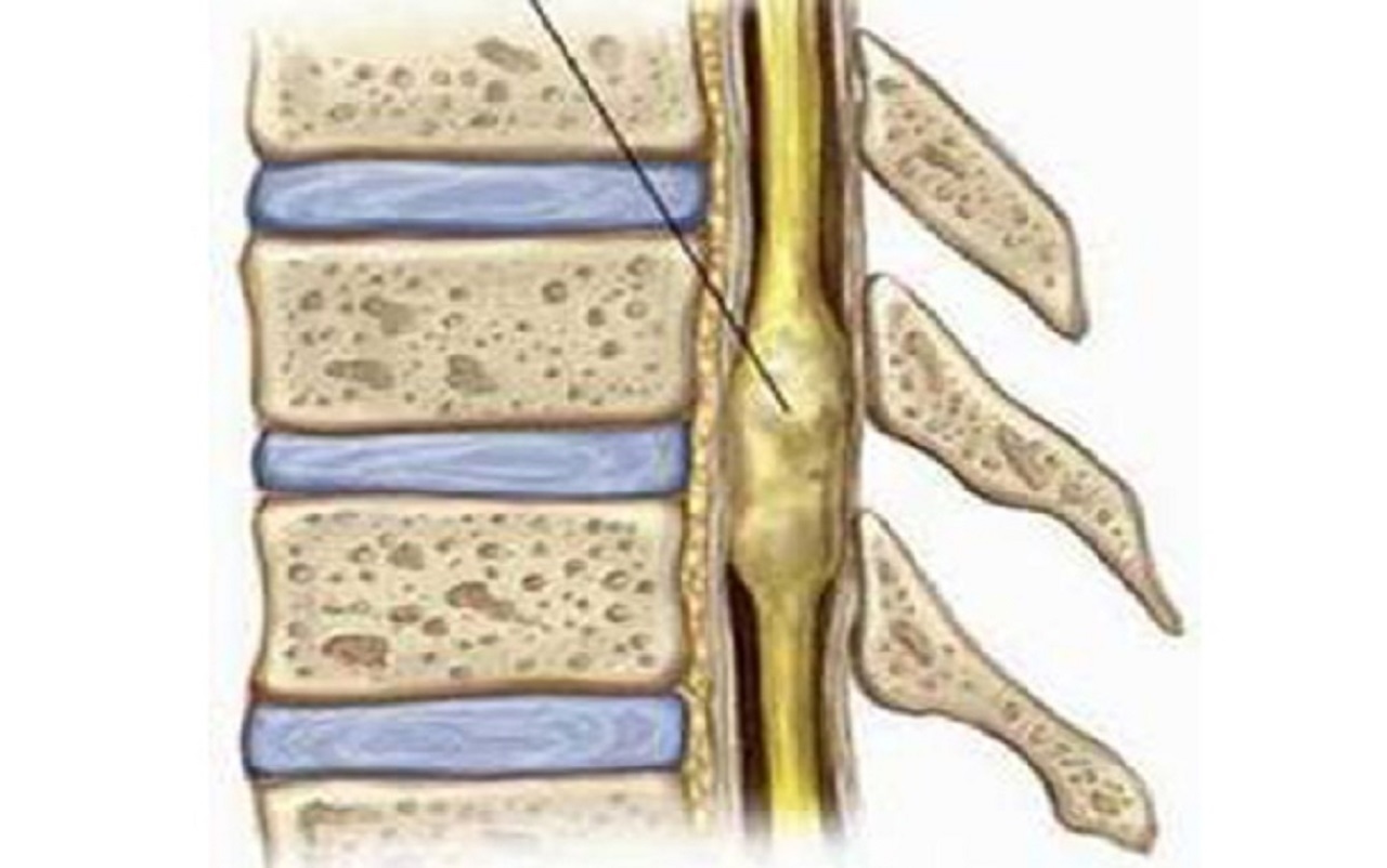 Tủy sống: cấu tạo, chức năng và bệnh lý tủy sống