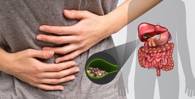 Triệu chứng bệnh sỏi túi mật