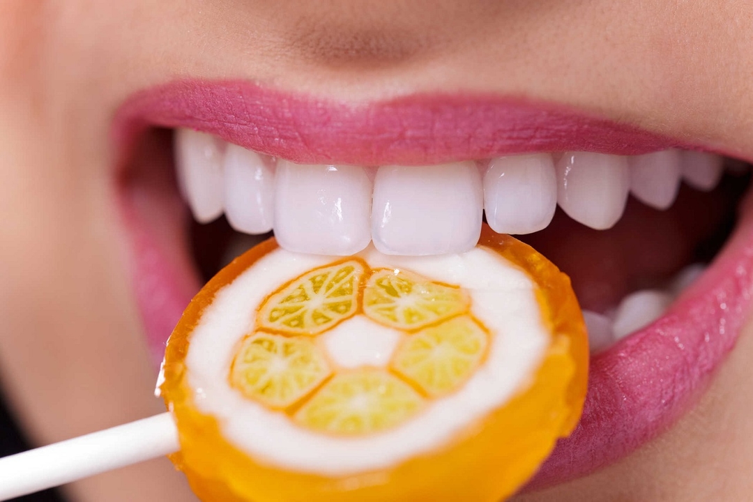 GIẢI ĐÁP: Sâu răng kiêng ăn gì?