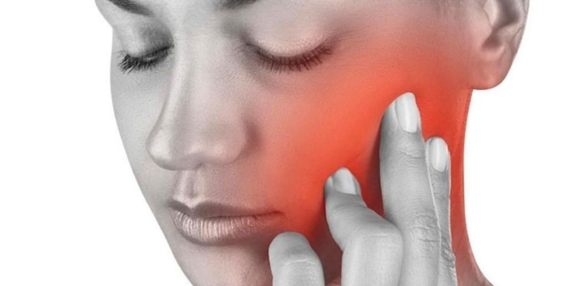 Viêm quanh cuống răng: Nguyên nhân, nhận biết, cách điều trị