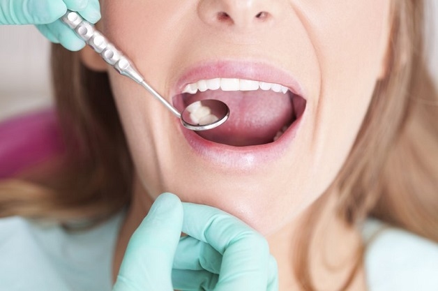 Tốt hơn hết, bạn nên thăm khám với các nha sĩ ngay khi có dấu hiệu để được điều trị viêm quanh cuống răng kịp thời