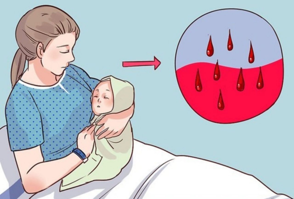 Rong kinh sau sinh mổ có nguy hiểm không?