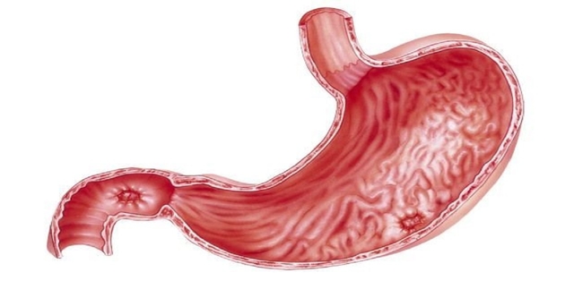 Cách chữa viêm loét hành tá tràng &#8211; những điều cần lưu ý 
