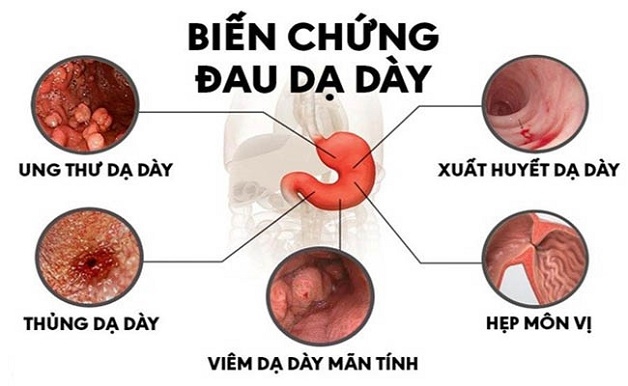 Nếu bệnh phát hiện muộn sẽ gây ra nhiều biến chứng nguy hiểm
