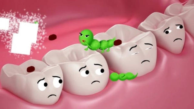 Tìm hiểu các cách ngừa sâu răng hiệu quả 