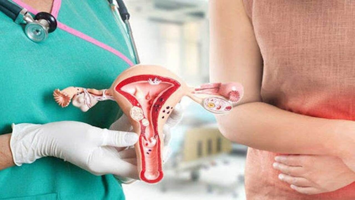 Bệnh u xơ tử cung và những biến chứng nguy hiểm cần biết