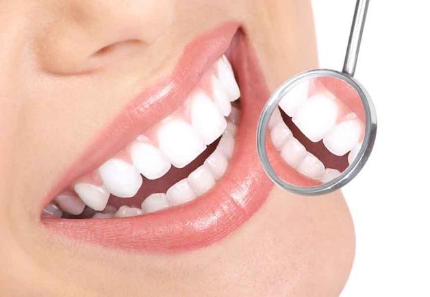 Bọc răng sứ xong có kiêng gì không?