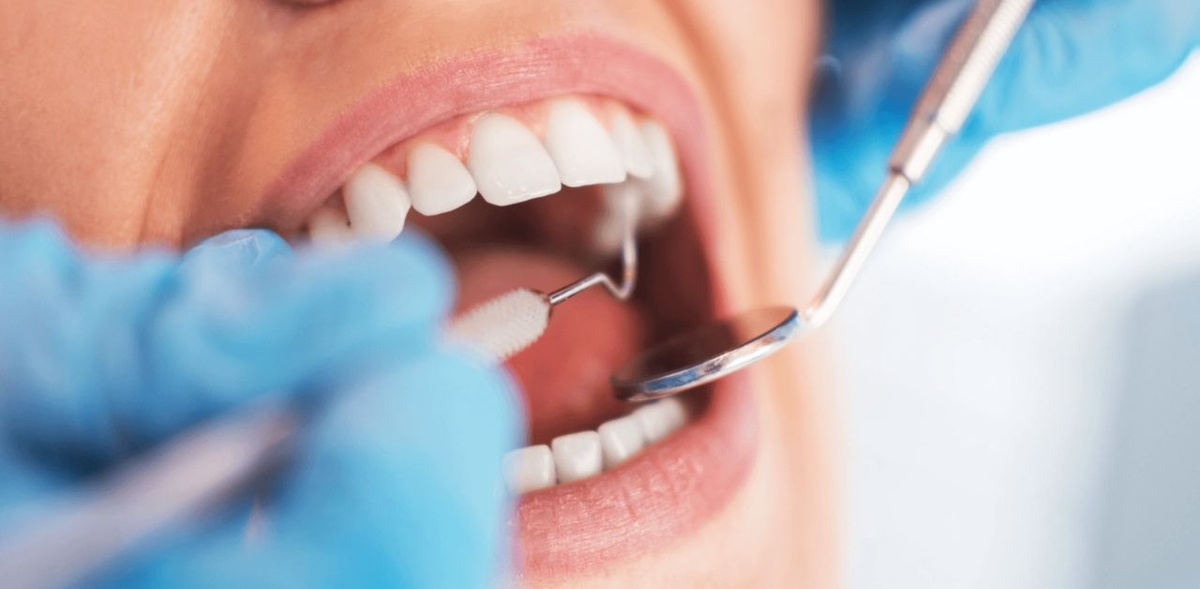 Bí quyết chăm sóc răng đã lấy tủy đúng cách