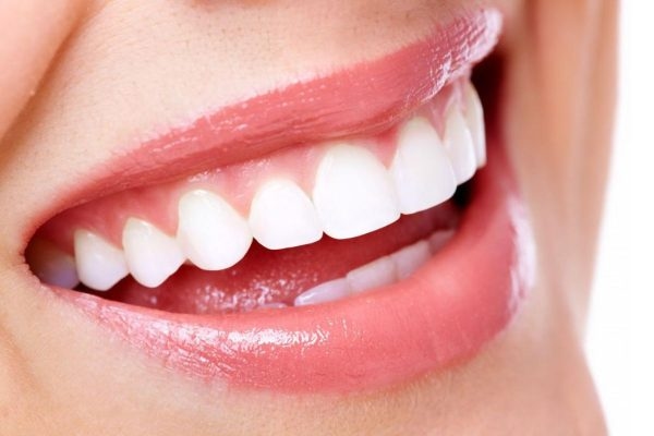 Răng dán sứ đều, thẩm mỹ giúp mọi người có thể sở hữu nụ cười tự tin, rạng ngời