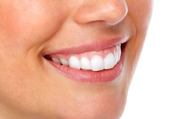 Lợi bị hở quá mức khi cười, khi nói chuyện được gọi là cười hở lợi 