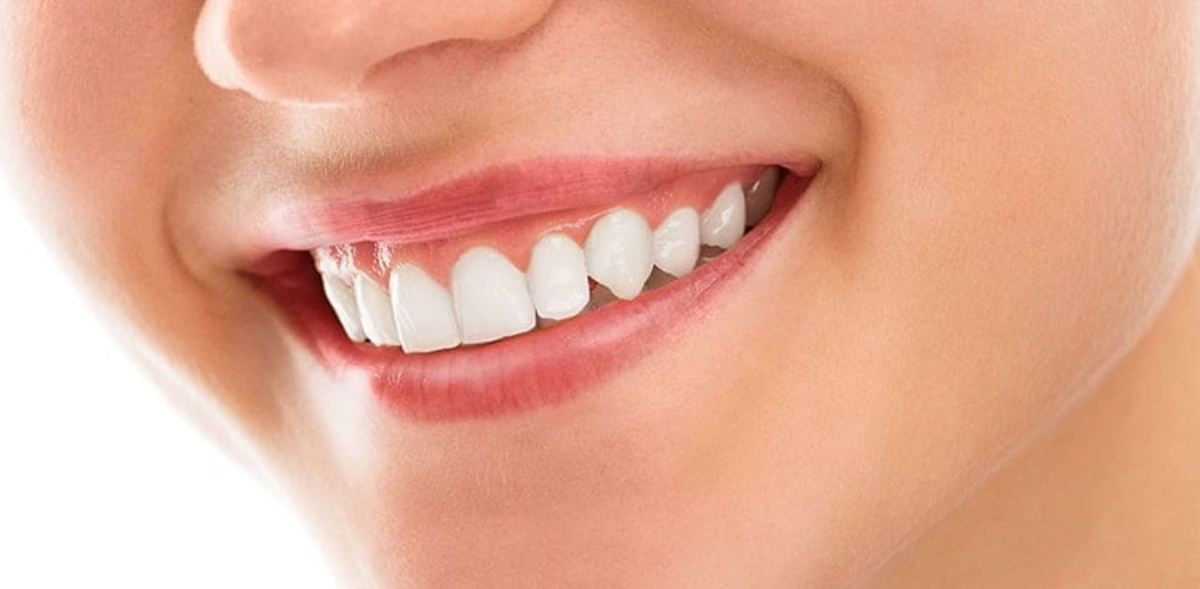 Tìm hiểu về phương pháp phẫu thuật đường cười hở lợi