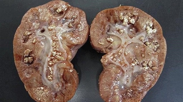 Một số trường hợp có thể áp dụng phương pháp này