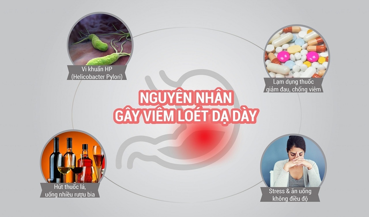 Viêm loét dạ dày nguyên nhân phổ biến, triệu chứng và cách điều trị