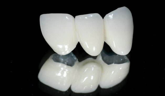 Phục hình cầu răng sứ có tính thẩm mỹ cao