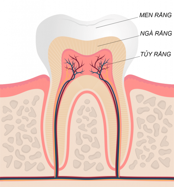 sâu tủy răng