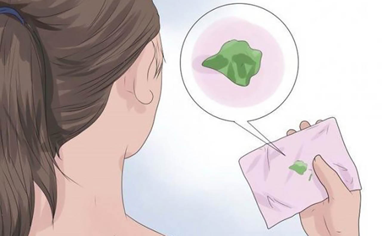 Ngứa vùng kín ra khí hư màu xanh, biểu hiện viêm âm đạo khó lường