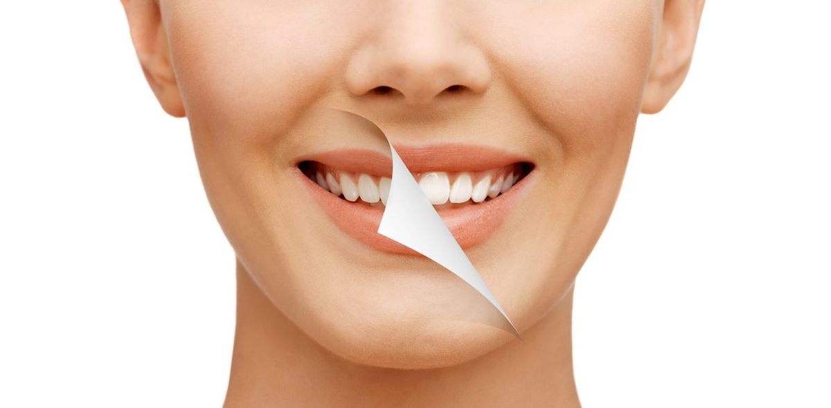 Tìm hiểu về các dịch vụ nha khoa thẩm mỹ hiện nay