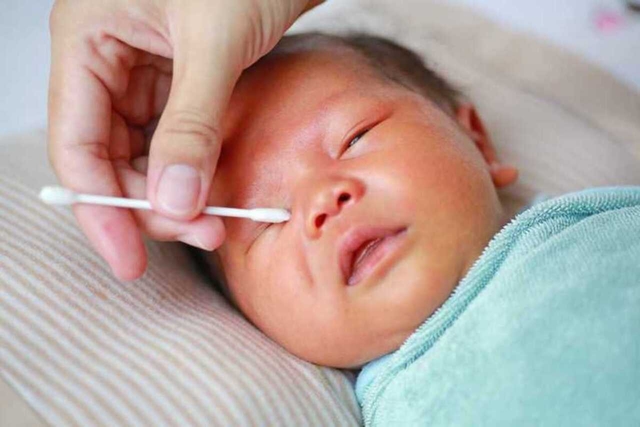 Các phương pháp khám u nguyên bào võng mạc