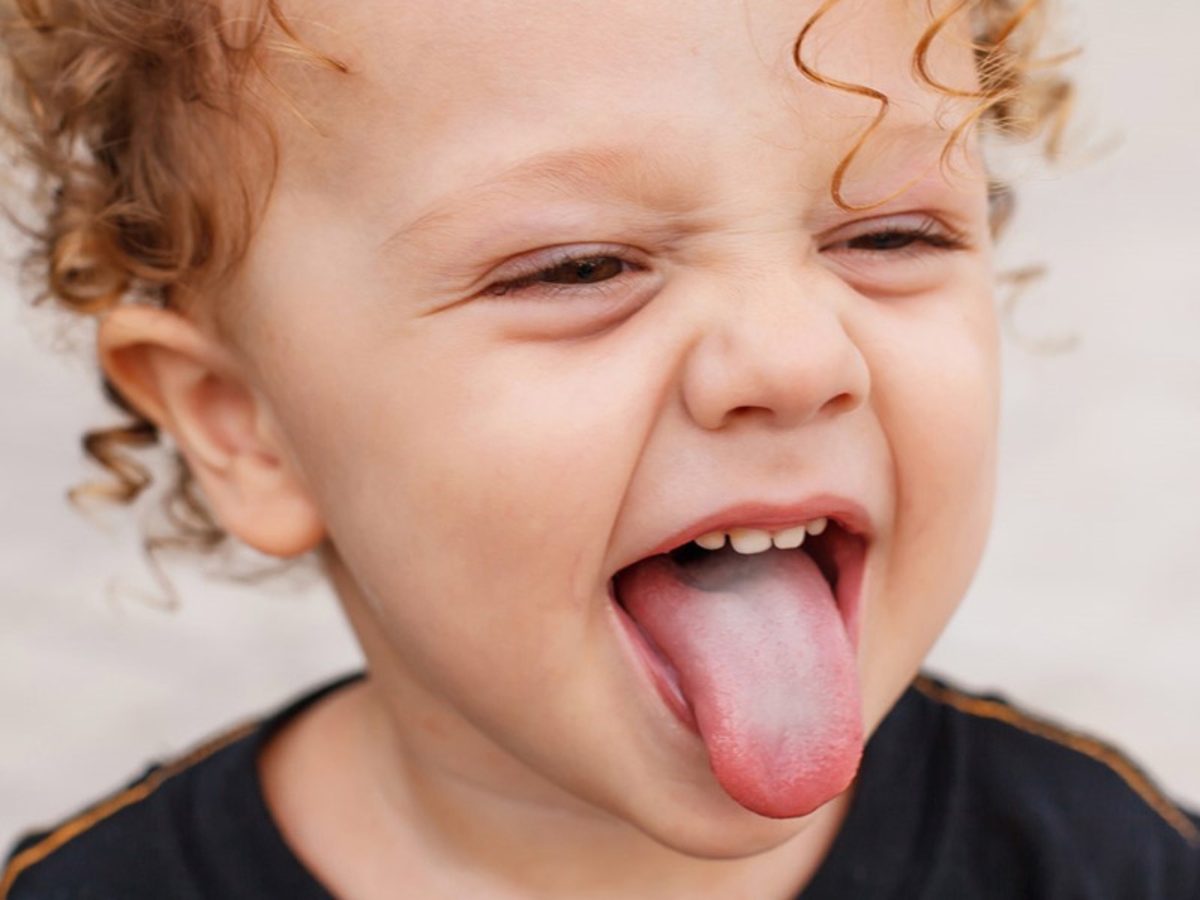 Chuyên gia giải đáp: Nấm miệng có tự khỏi được không?