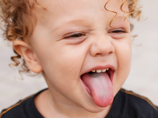 Chuyên gia giải đáp: Nấm miệng có tự khỏi được không?