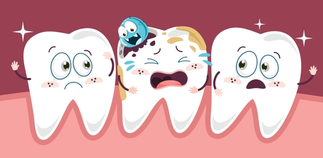 Răng hàm sâu nặng &#8211; Biến chứng nguy hiểm, cần điều trị kịp thời