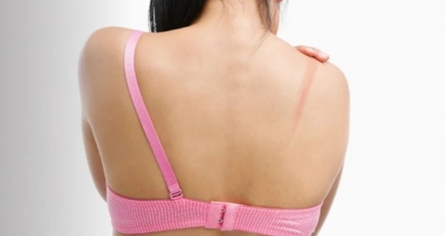 tắc sữa 1 bên