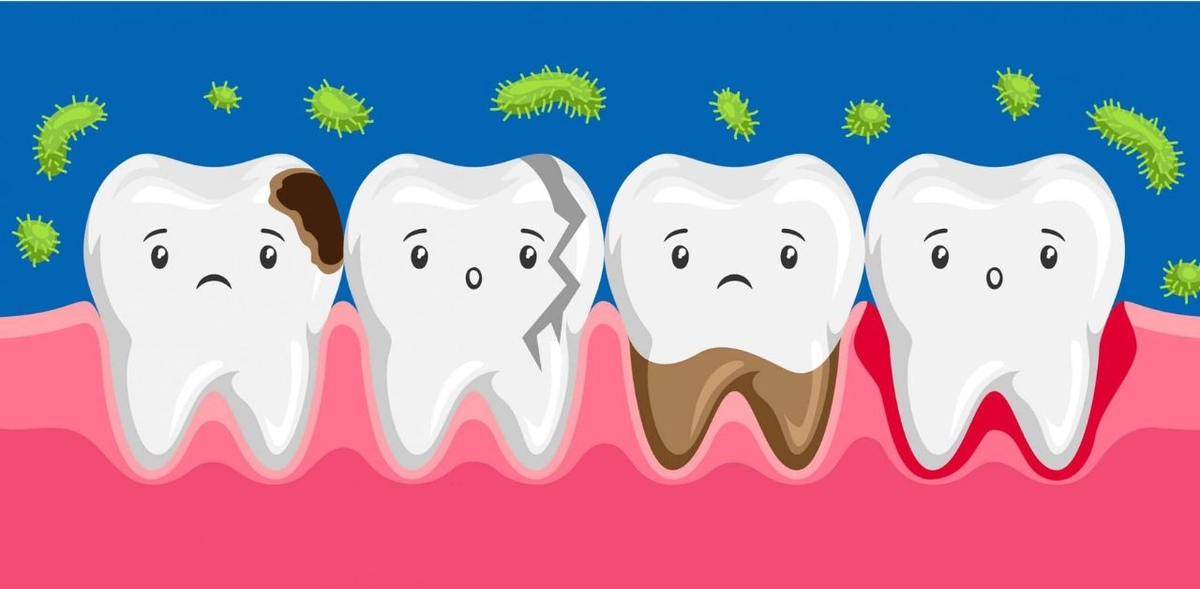 Các phương pháp trị sâu răng vĩnh viễn, hiệu quả cao