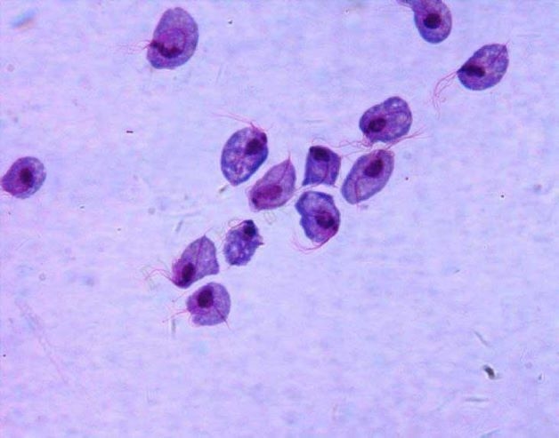Nhiễm nấm candida là nguyên nhân gây nên bệnh nấm phụ khoa ở nữ giới