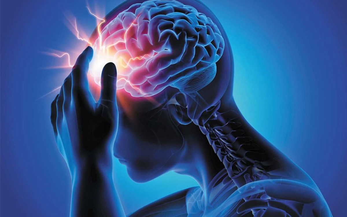Nhận biết các dấu hiệu của đột quỵ nhồi máu não