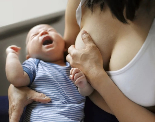 Tắc tia sữa mưng mủ: Nguyên nhân và cách chữa trị hiệu quả