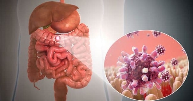 Viêm đại tràng vi thể