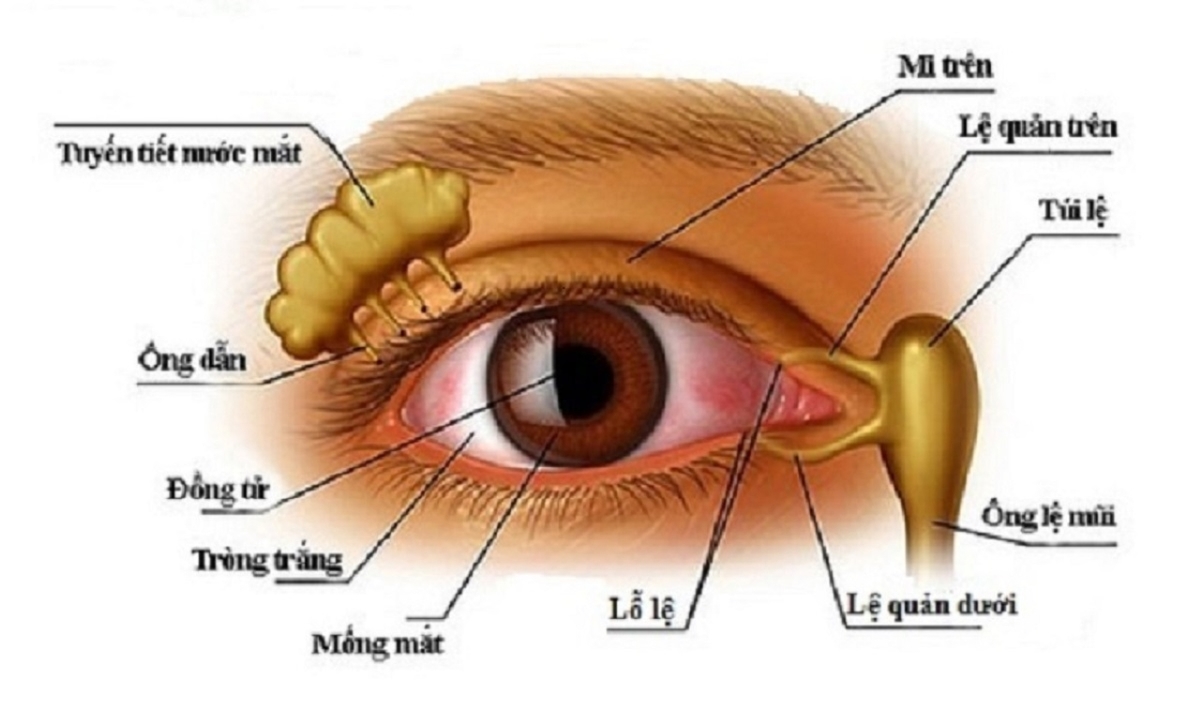 Bệnh viêm lệ đạo và những điều cần biết khi mắc phải