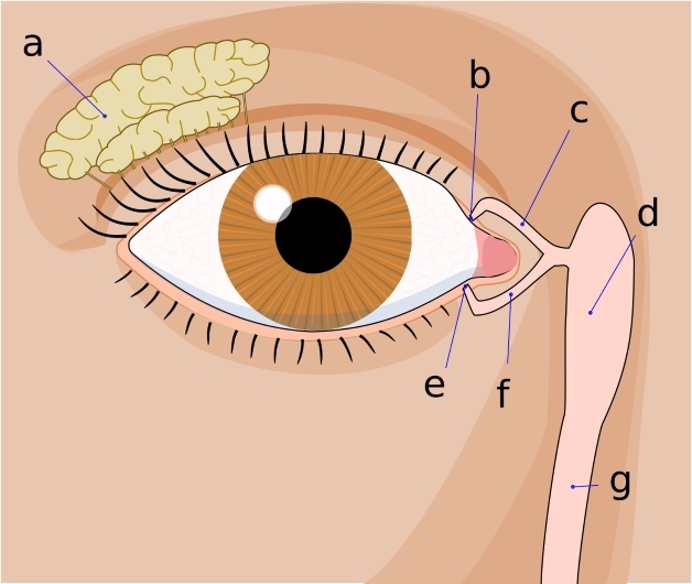 viêm lệ đạo