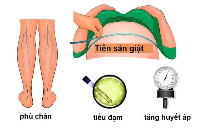 Tiền sản giật khi mang thai có thể dẫn đến sản giật