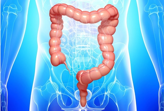 Viêm niêm mạc đại tràng là gì