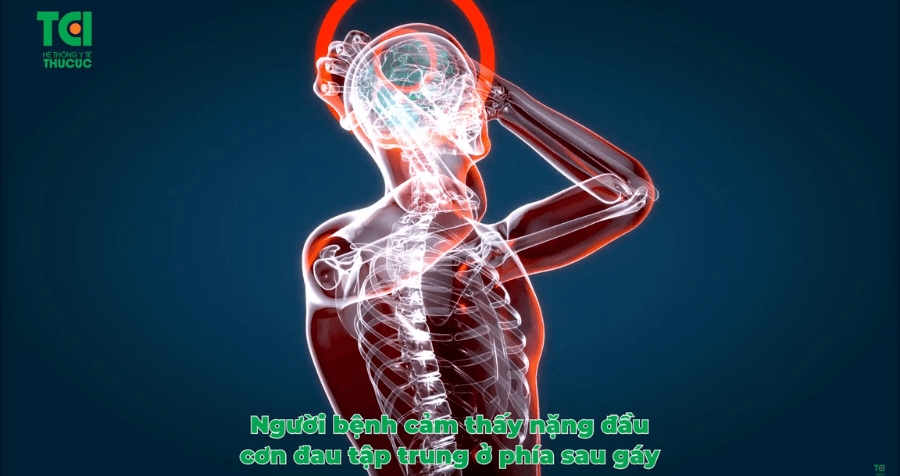Thiếu máu não: Dấu hiệu nhận biết và biến chứng nguy hiểm