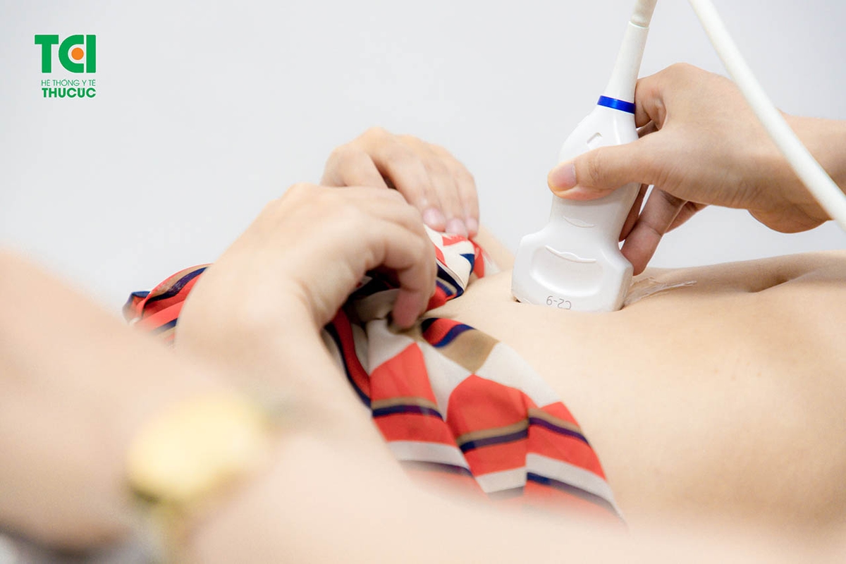 Nguyên nhân đau 2 bên buồng trứng &#8211; u nang buồng trứng