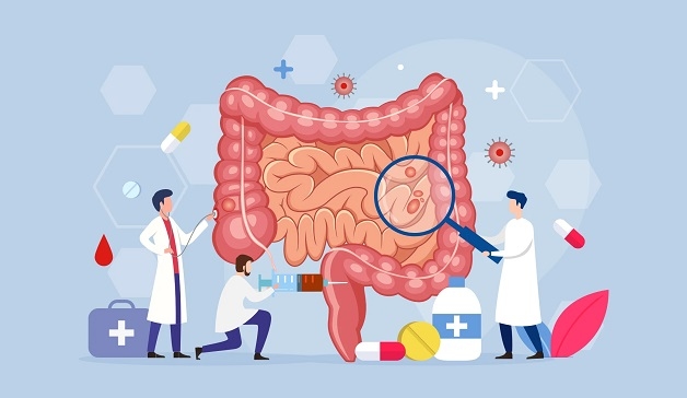 Điều trị viêm ruột như thế nào?