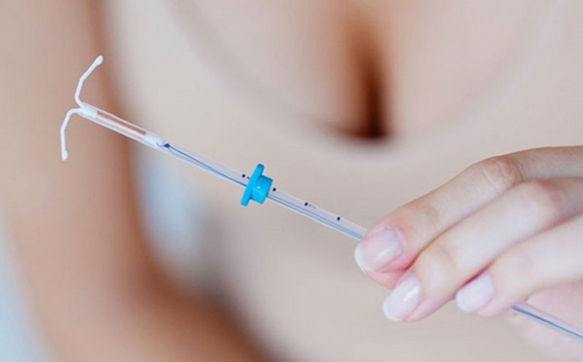Vòng tránh thai iud và những điều bạn cần biết