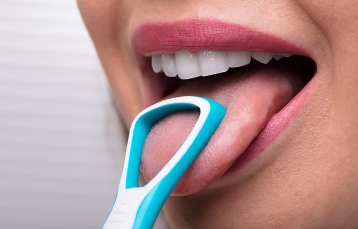 Cạo lưỡi có tốt không? Có nên làm mỗi ngày?