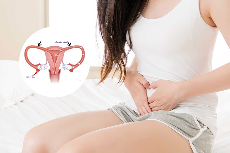 Có thai ngoài tử cung nguyên nhân rất đa dạng, có thể do ống dẫn trứng bị viêm, bị nhiễm trùng, dị dạng,...